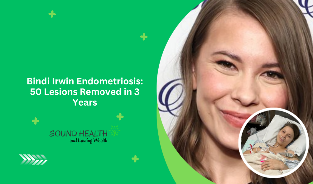 Bindi Irwin Endometriosis: 50 Lesions Removed in 3 Years Bindi Irwin Endometriosis: 50 Lesions Removed in 3 Years